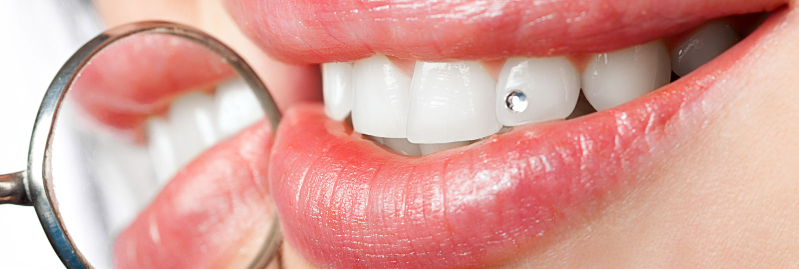 Tooth Gems: All You Should Know About Teeth Jewelry