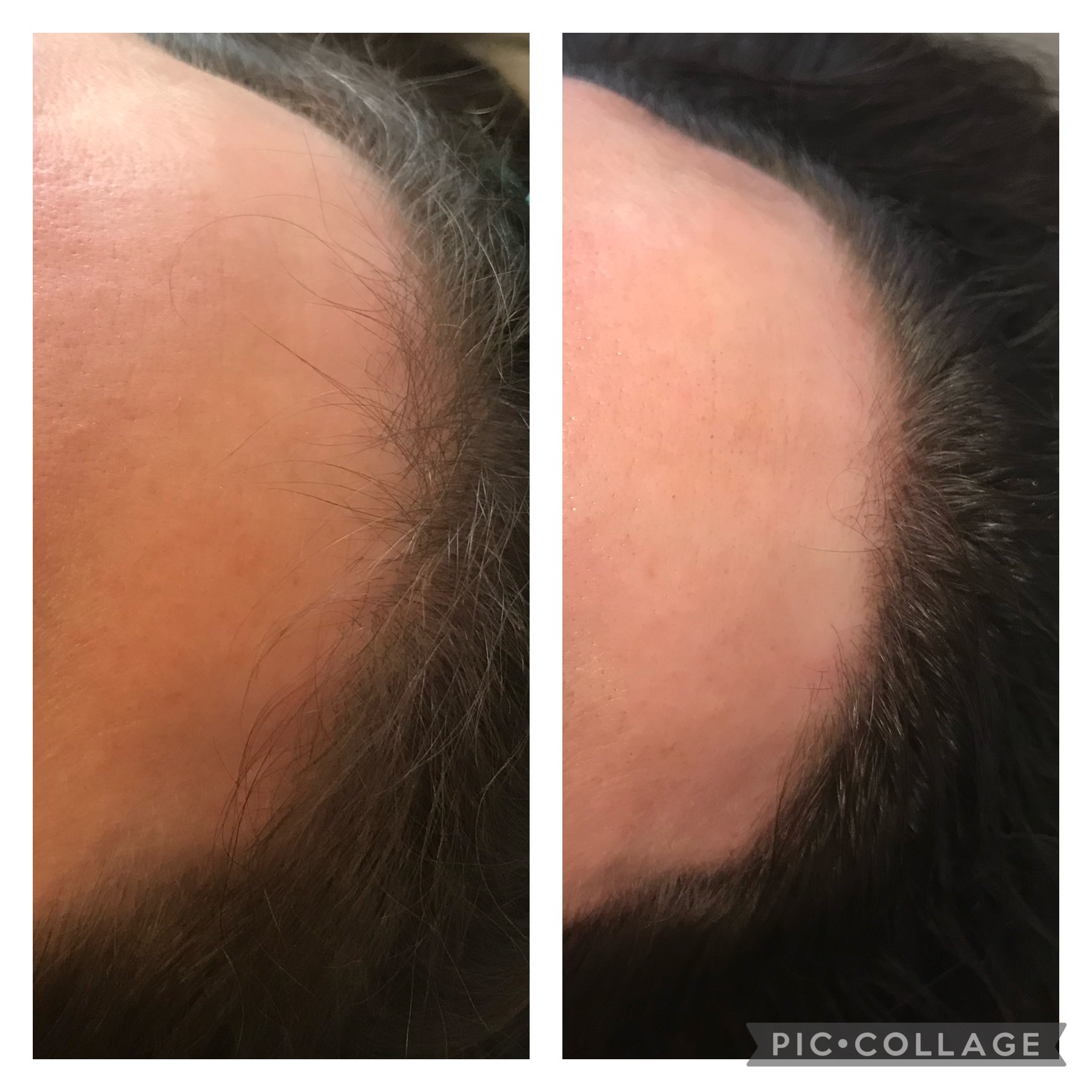 microblading-1