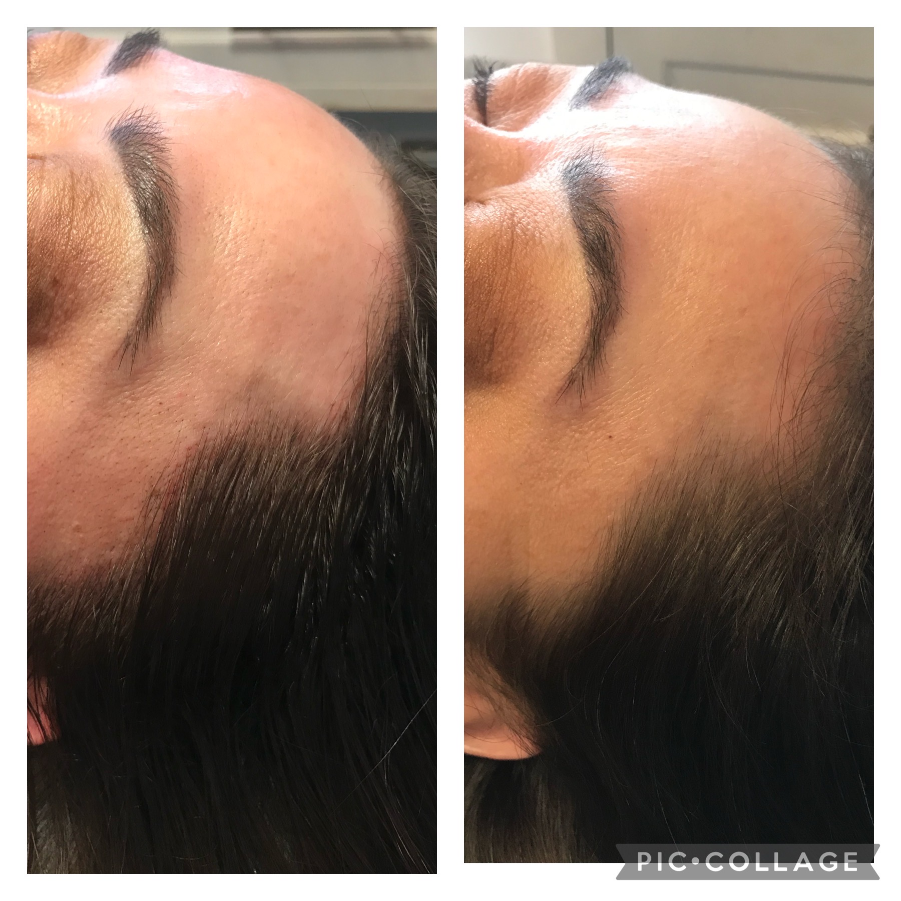 microblading-2