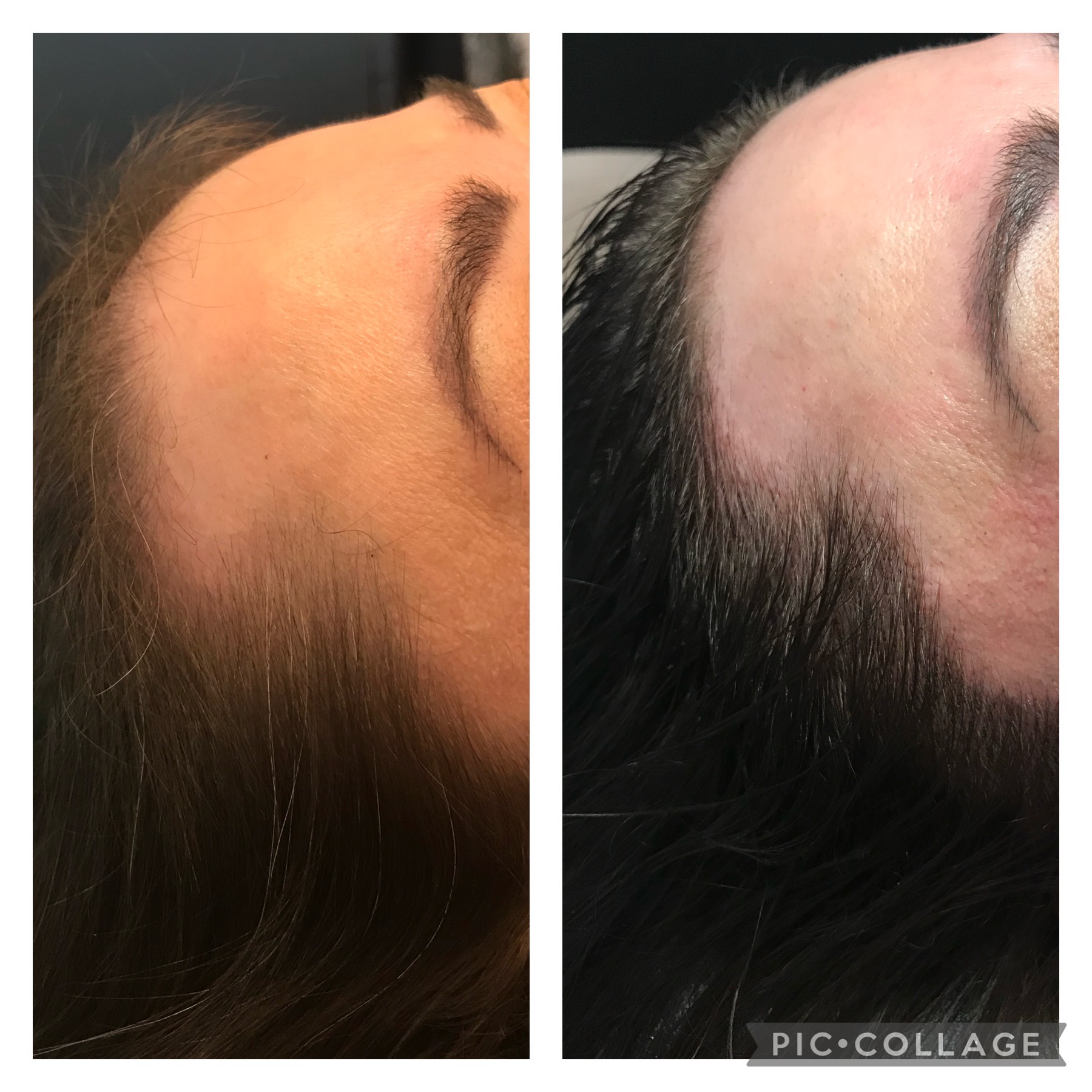 microblading-3