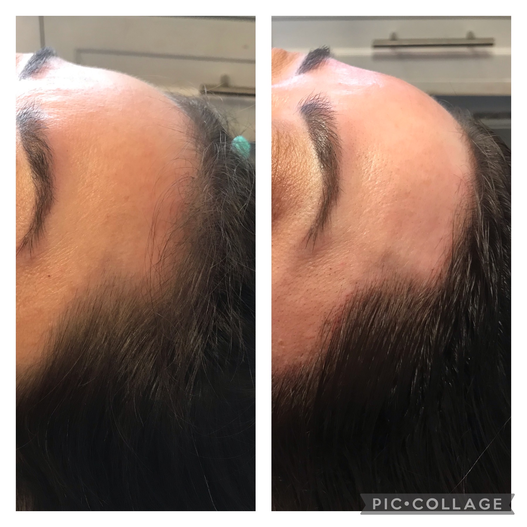 microblading-7