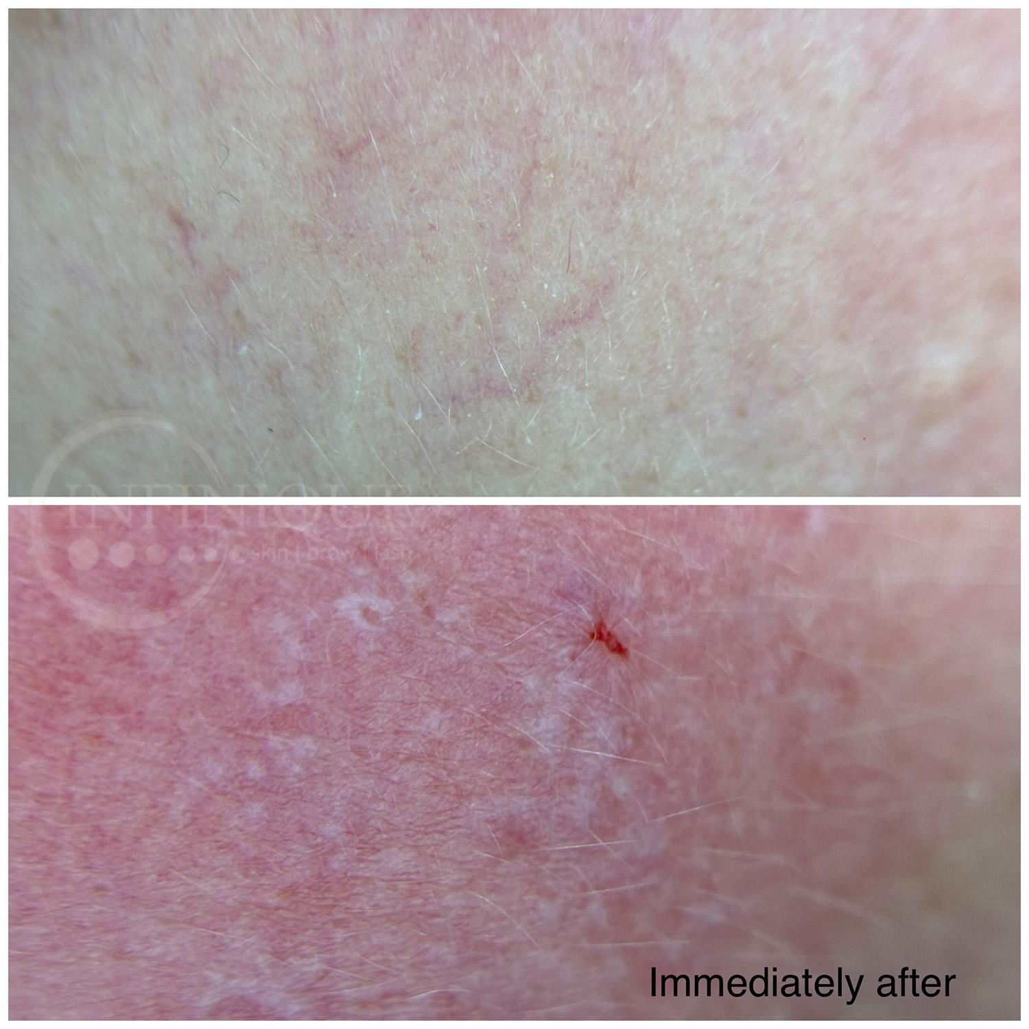 infinique-capillary-slide9