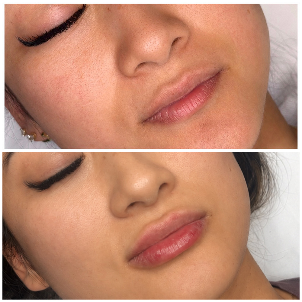 infinique-lip-filler-26-3