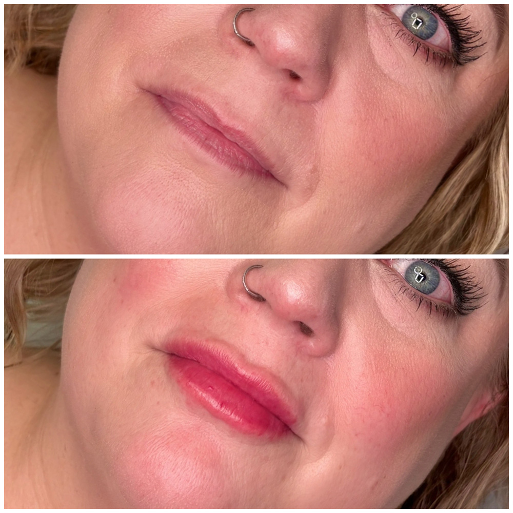 infinique-lip-filler-26-4