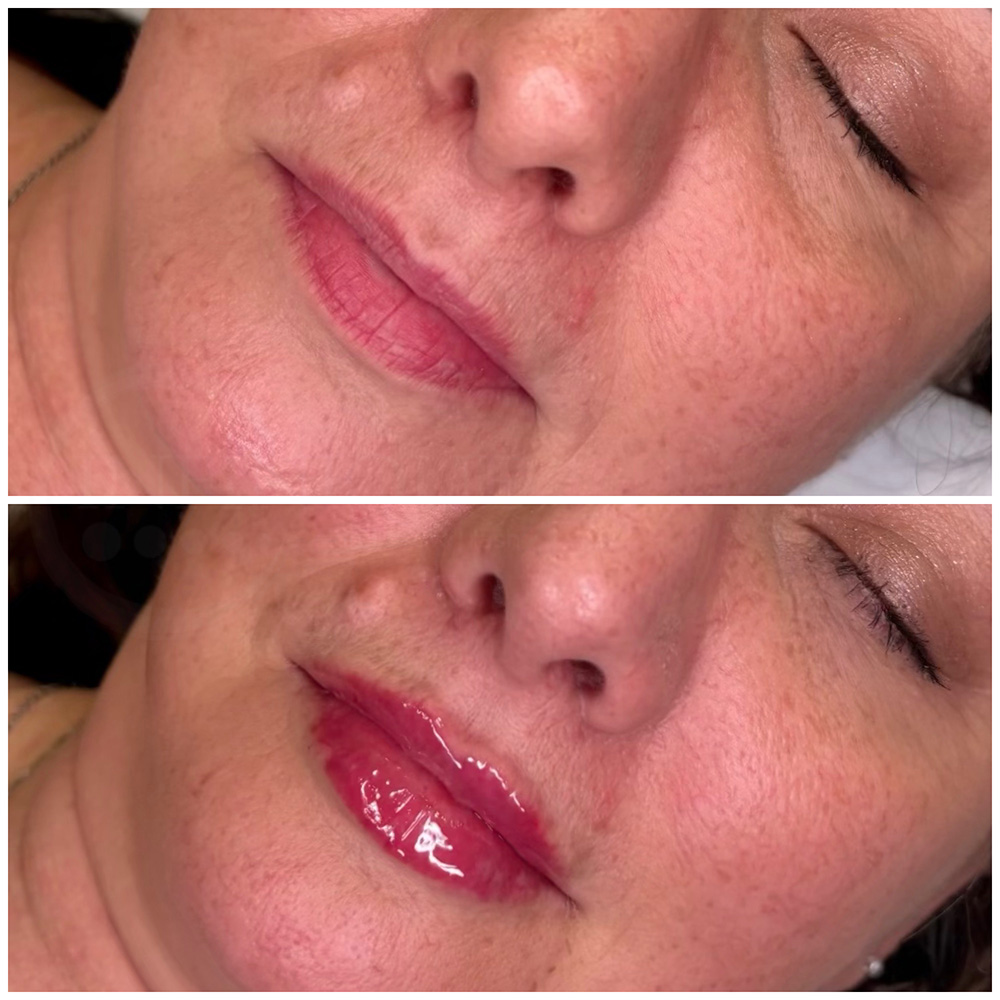 infinique-lip-filler-26-5