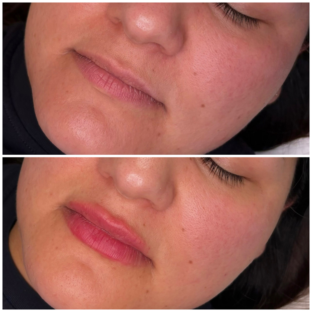 infinique-lip-filler-26-6