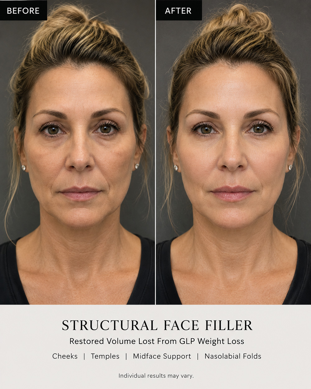 infinique-structure-face-1