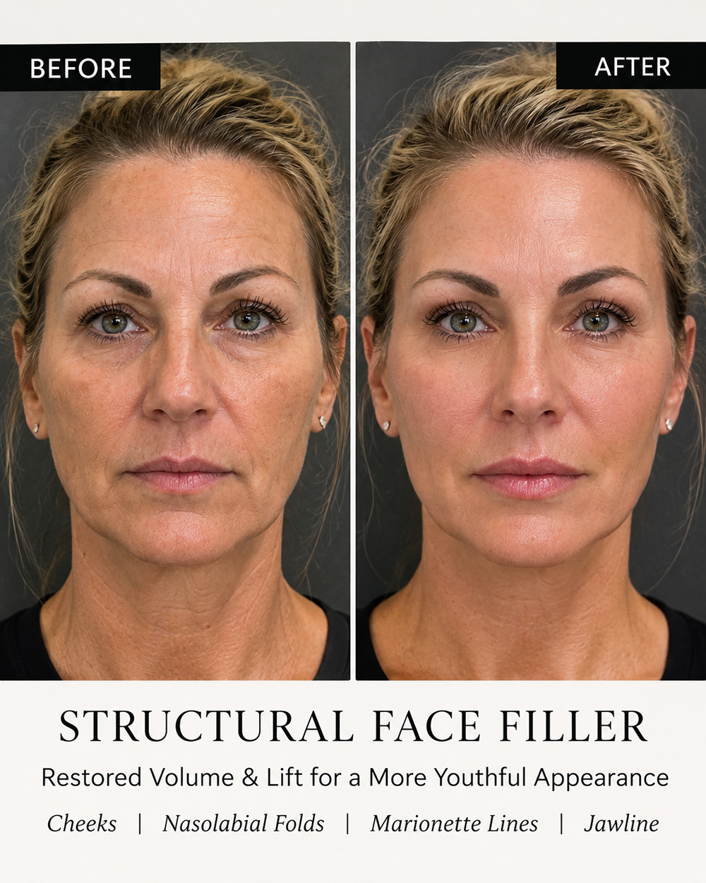 infinique-structure-face-2