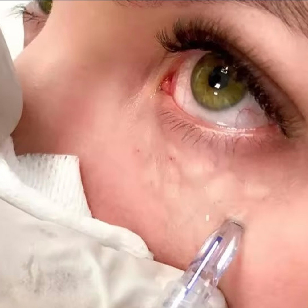 infinique-under-eye-0