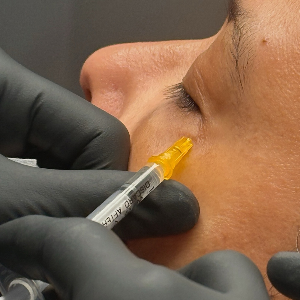 infinique-under-eye-2