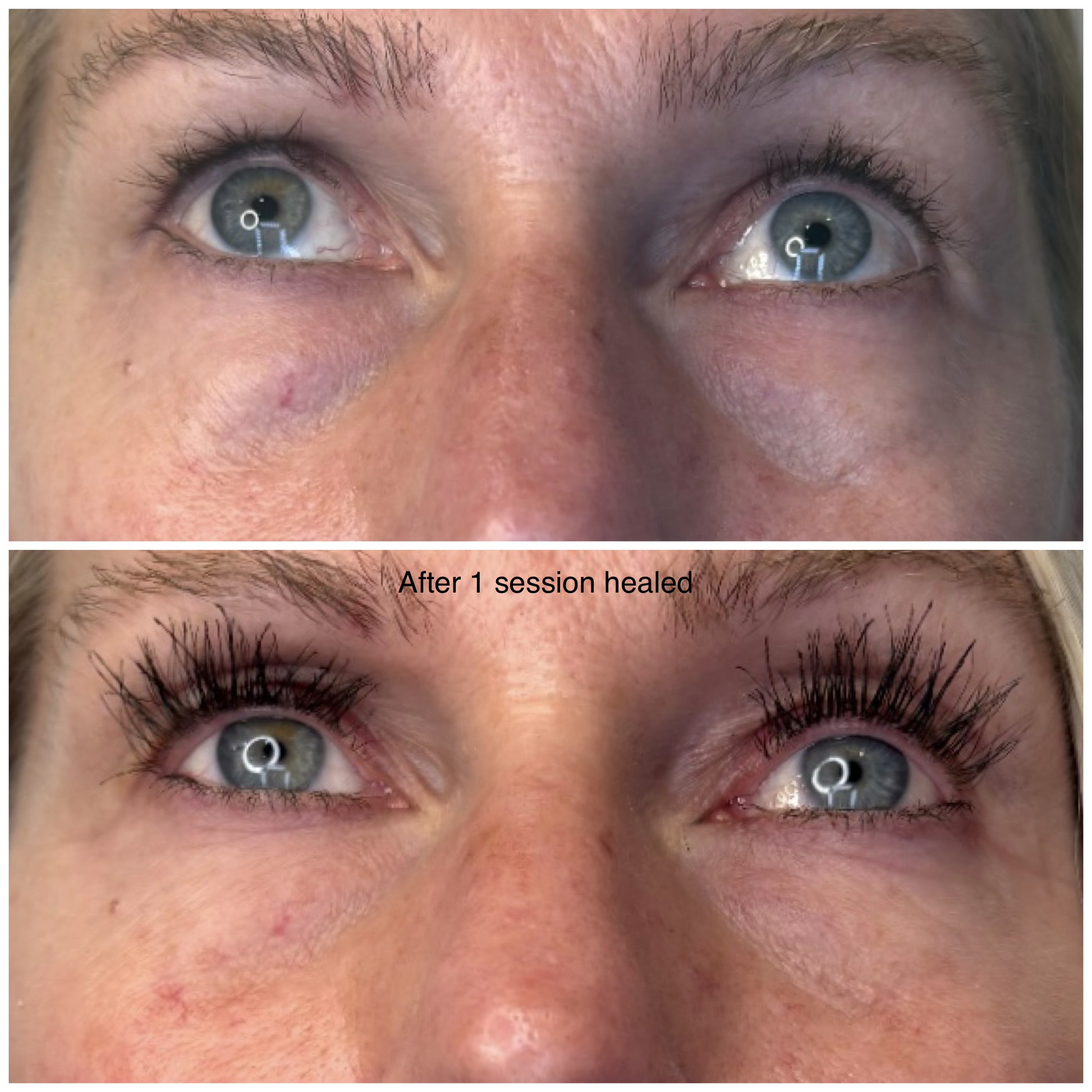 infinique-under-eye-3