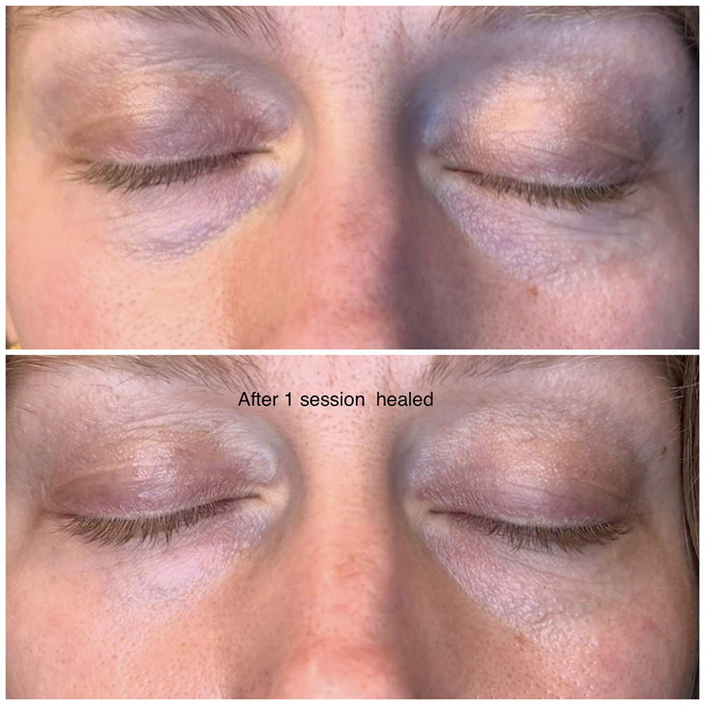 infinique-under-eye-4