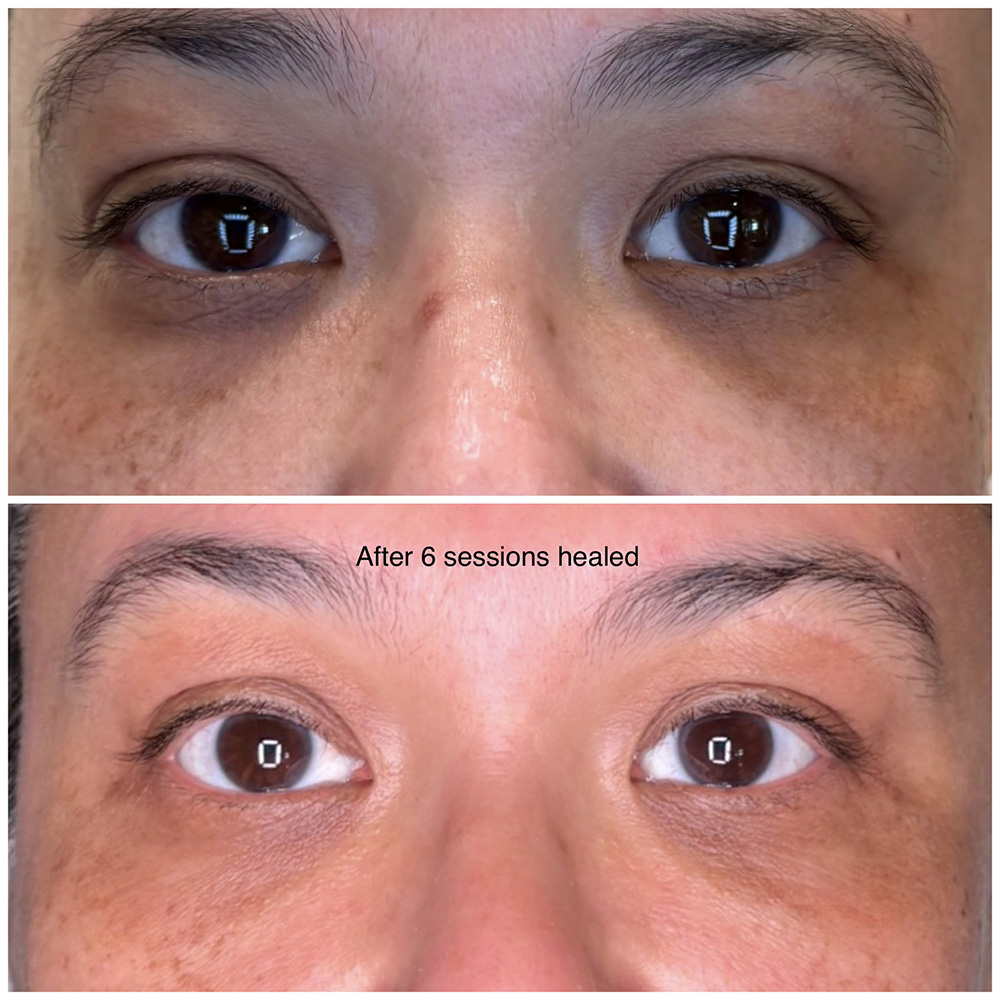 infinique-under-eye-8